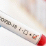 Восемь человек с Covid-19 умерли за сутки в Крыму и Севастополе, выявлены 293 зараженных - НеФакт.Инфо