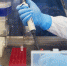 В Крыму зарегистрировано 125 случаев коронавирусной инфекции - RuInformer.Com